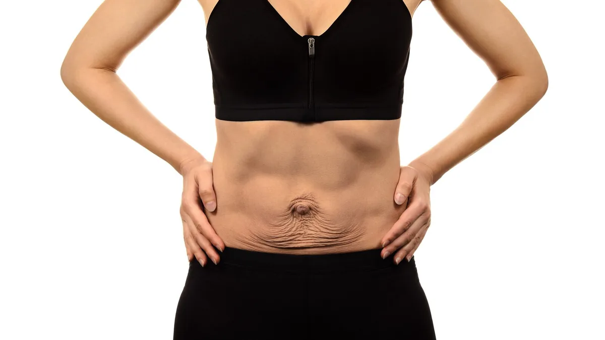 Fisioterapia diastasi addominale post parto Roma