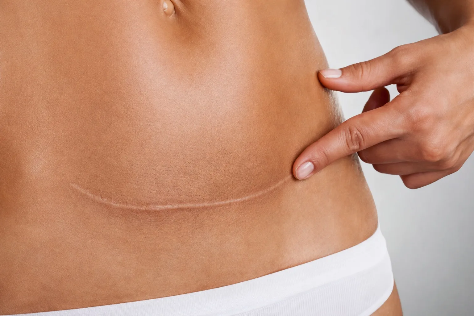 Fisioterapia recupero post gravidanza cicatrice cesareo Roma